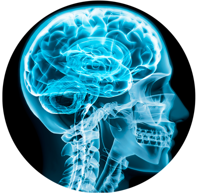 imagen_cerebro_iis_